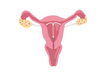 Spiral hakkında merak edilenler!