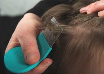 Bit nasıl temizlenir? En etkili bit temizleyen 3 doğal yöntem