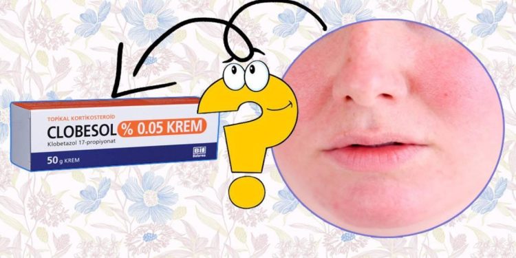 Clobesol krem nedir ve ne için kullanılır? Clobesol krem yan etkileri ve fiyatı 2023